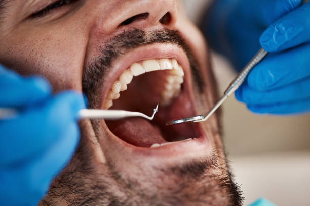 Emergency Dental Services in Cavalero, WA